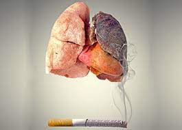 Cancer du poumon : trois origines découvertes chez les non-fumeurs