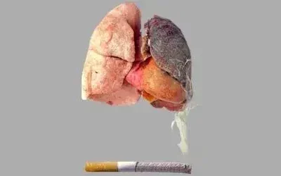 Faut-il interdire le tabac pour lutter contre les cancers du poumon ?