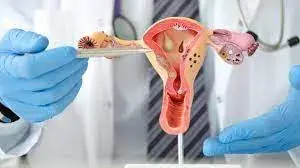 Le cancer du col de l’utérus : symptômes, causes et prévention